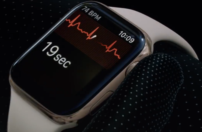 Apple Watch EKG